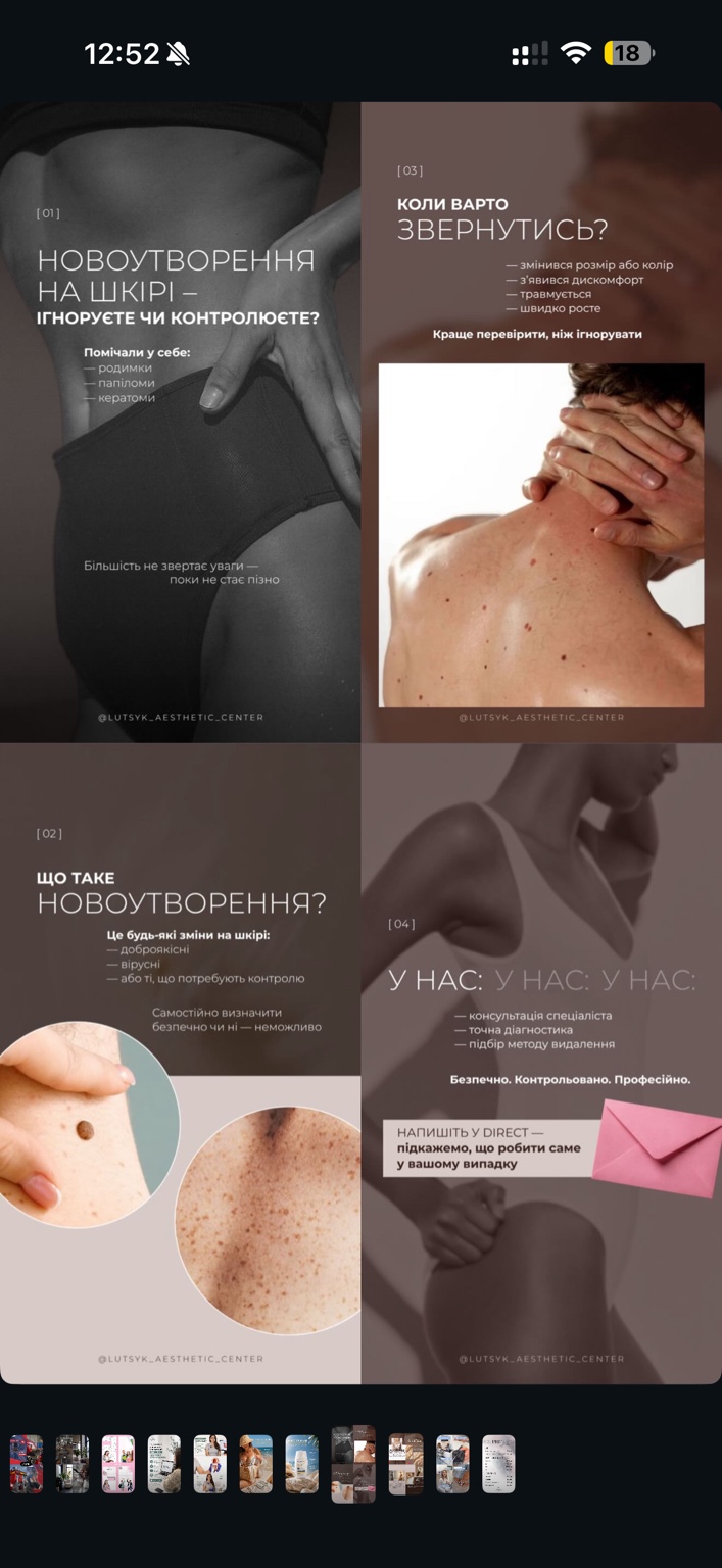 Оформлення Stories