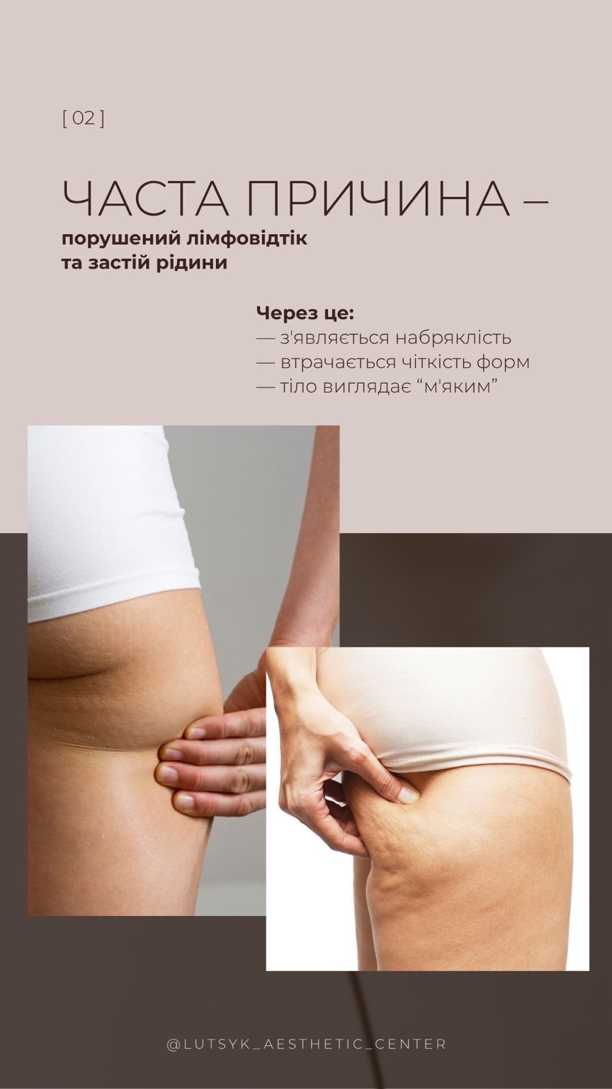 Оформлення Stories